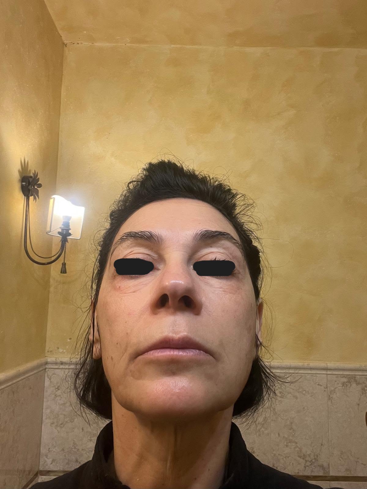 After — subject face, eyes obscured
