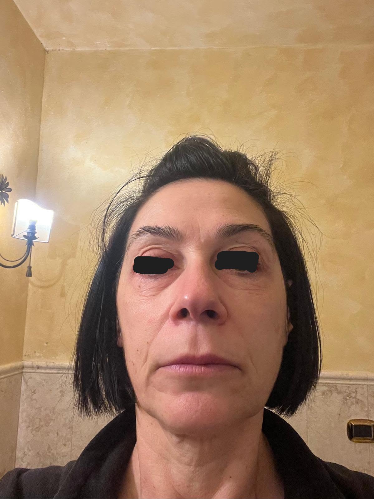Before — subject face, eyes obscured
